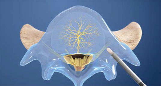 Illustration of spinal column