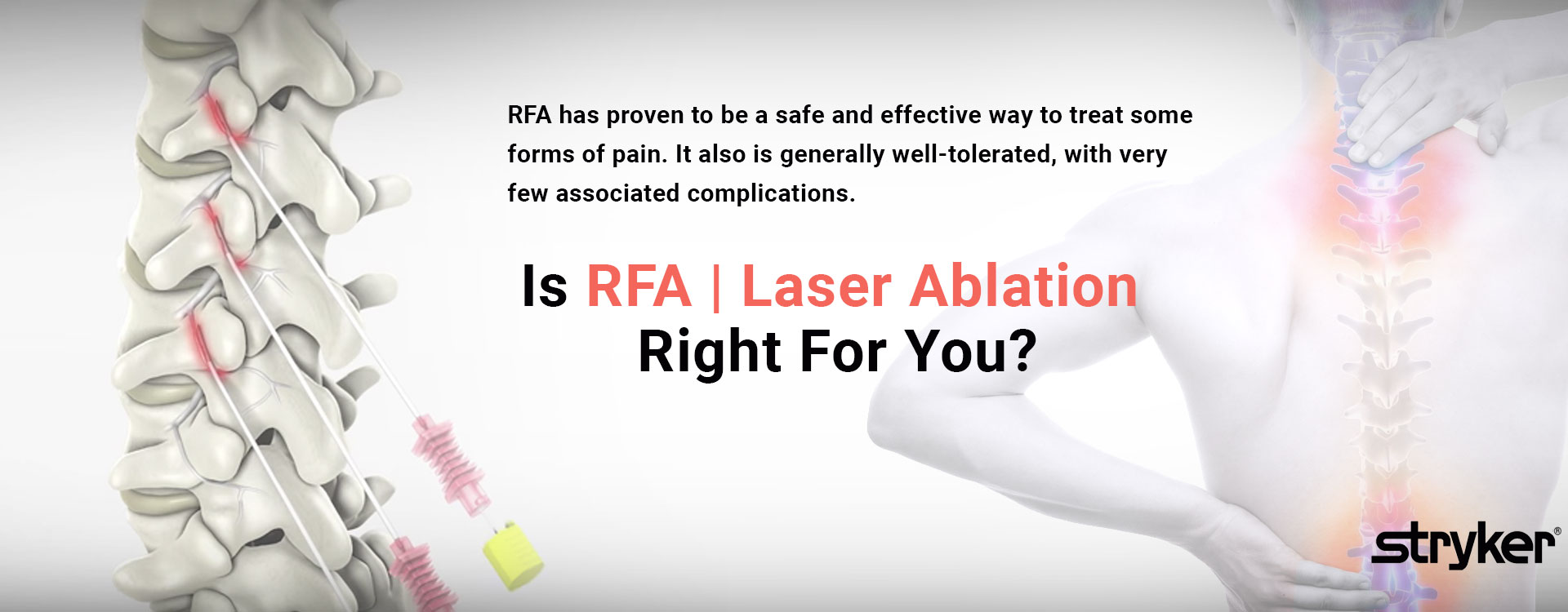 RFA Laser Ablation Slider Image
